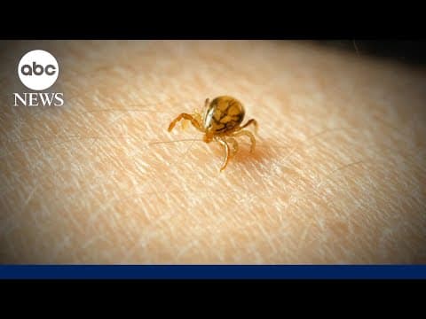 What to know about meat allergies caused by tick bites